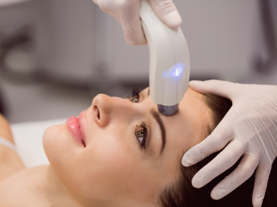 Laser Acne Scar Treatment