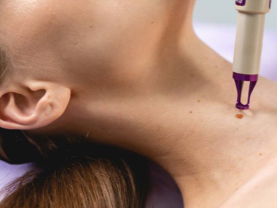 What is done in decollete and neck aesthetics?