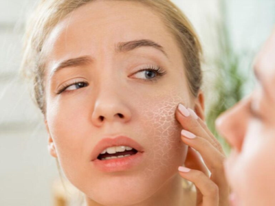 What You Need to Know to Prevent Pore Formation