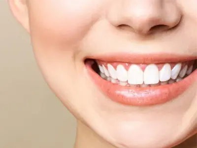 How is a gummy smile treated?