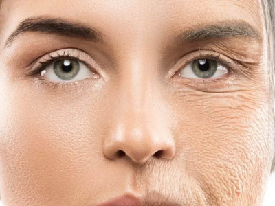 Which procedures do we do for the eye area?