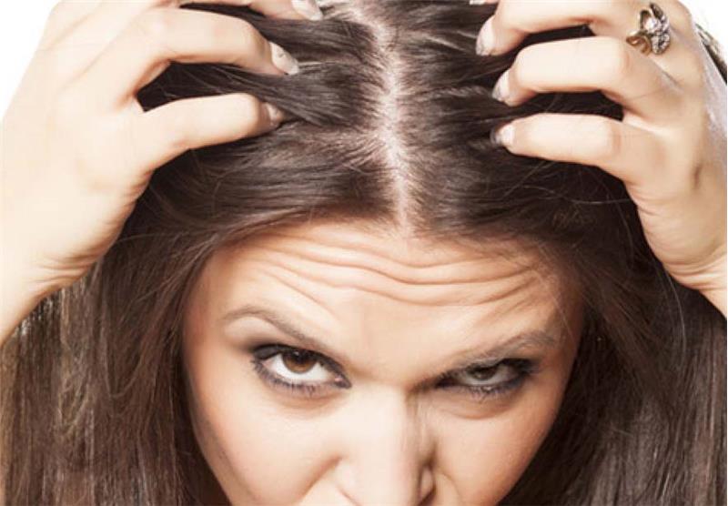 Alopecia Areata Treatment